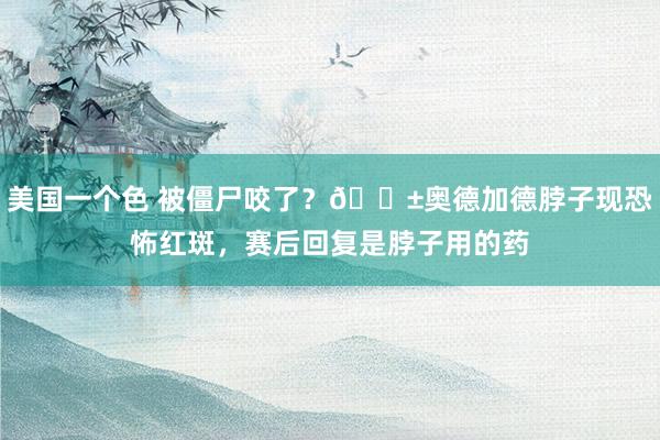 美国一个色 被僵尸咬了？😱奥德加德脖子现恐怖红斑，赛后回复是脖子用的药